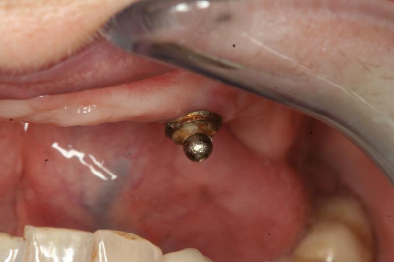 Angiology e chirurgia vascolare