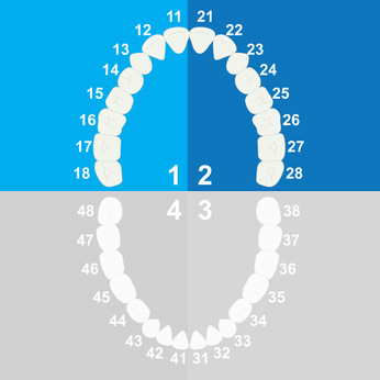 impianti dentali circolare superiore Torino Brandizzo