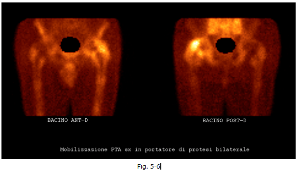 diagnostica-nucleare-2