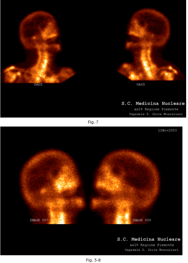 diagnostica-nucleare-3