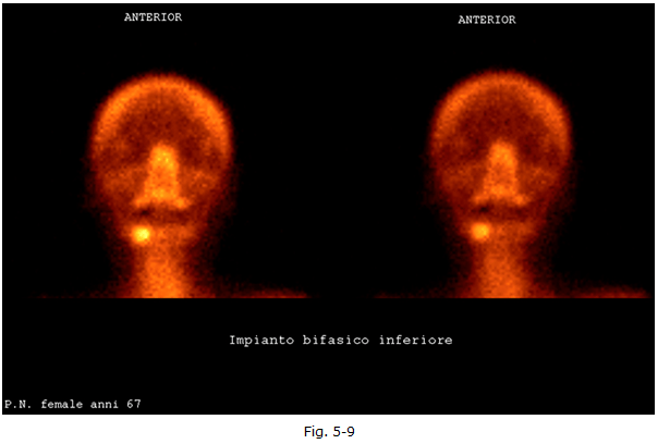 diagnostica-nucleare-4