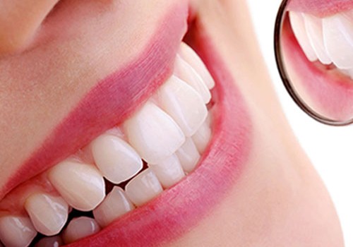 Come sbiancare i denti velocemente in modo professionale: denti bianchi in pochi minuti Come sbiancare i denti velocemente in modo professionale: denti bianchi in pochi minuti