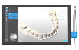 Impronte dentali: digitali