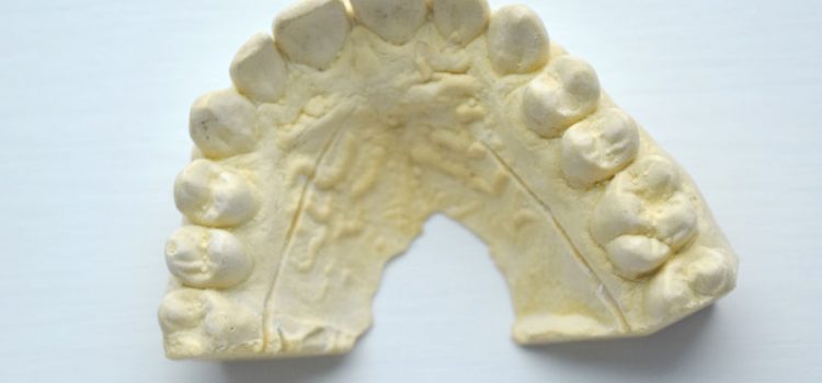 Impronte dentali digitali Impronte dentali digitali