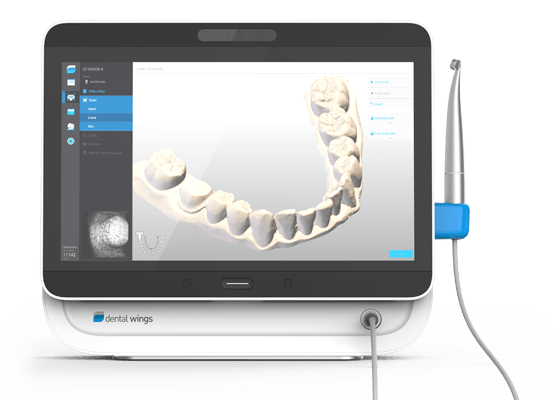 Impronta dentale 3d con manipolo intraorale Dental Wings